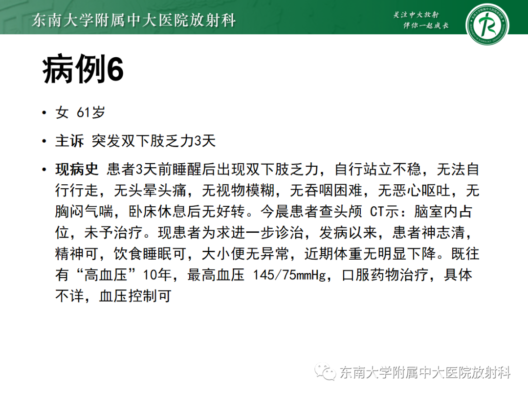 影像PPT - 【PPT】髓母细胞瘤-41