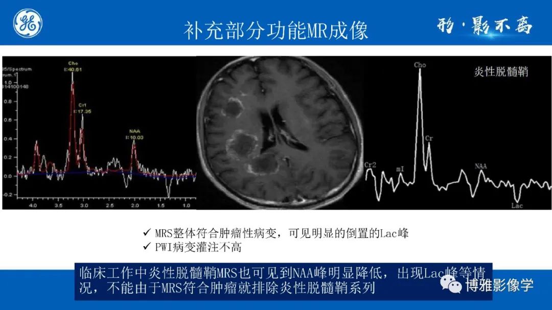 影像PPT - 【PPT】临影结合看图识病之单侧基底节病变解析-15