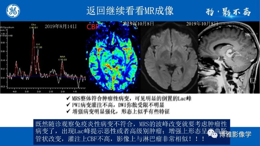 影像PPT - 【PPT】临影结合看图识病之单侧基底节病变解析-20