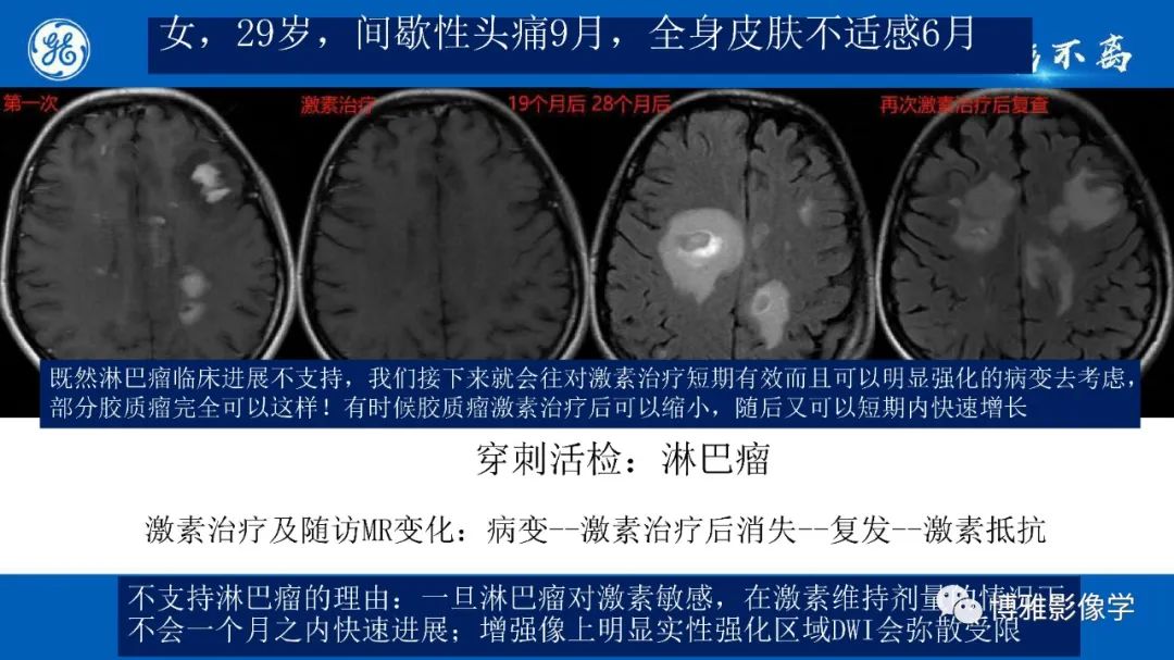 影像PPT - 【PPT】临影结合看图识病之单侧基底节病变解析-23