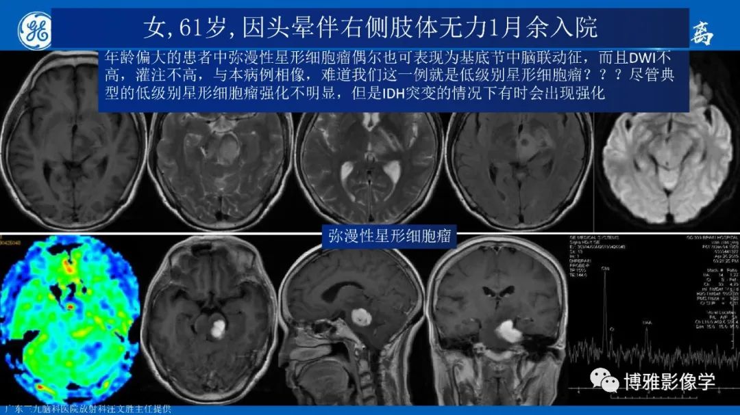 影像PPT - 【PPT】临影结合看图识病之单侧基底节病变解析-27