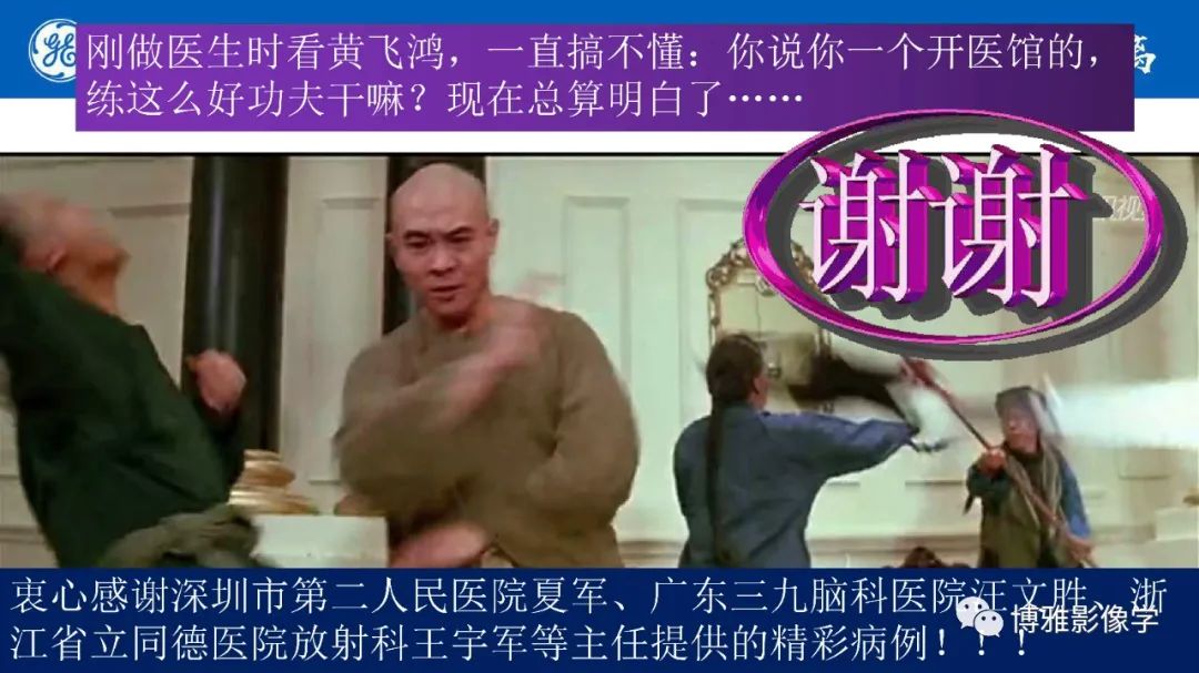 影像PPT - 【PPT】临影结合看图识病之单侧基底节病变解析-36