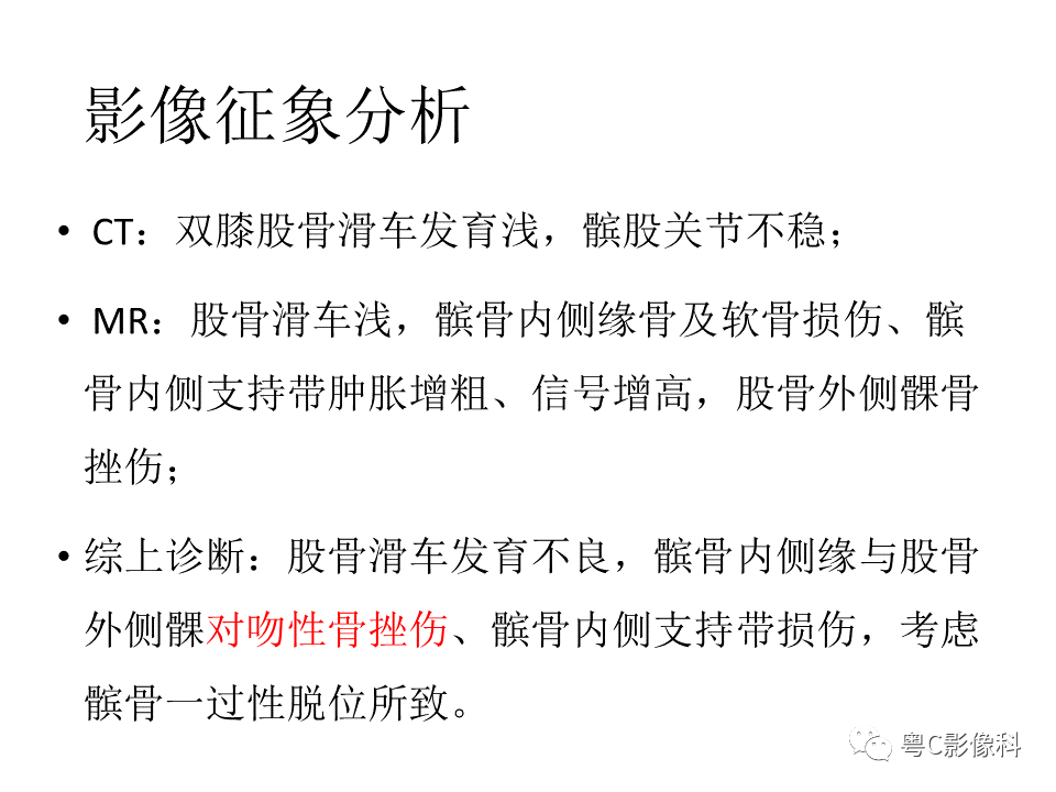 影像PPT - 【病例】一过性髌骨脱位1例CT及MR影像表现-11 影像PPT - 【病例】一过性髌骨脱位1例CT及MR影像表现-11