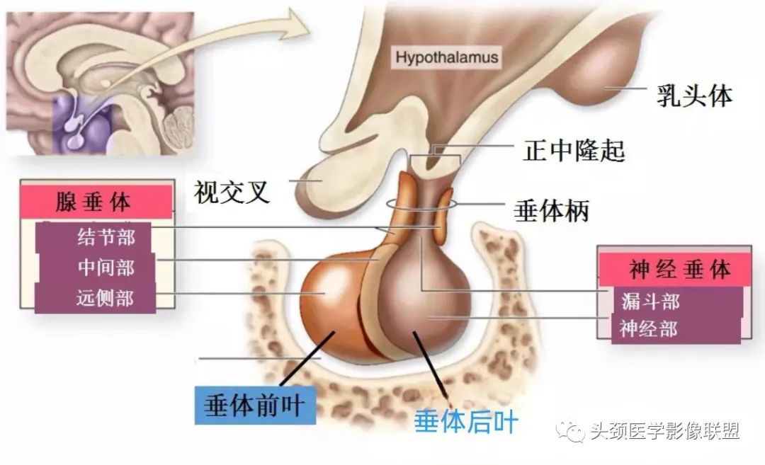 影像PPT - 垂体腺瘤的“丛征”-3 影像PPT - 垂体腺瘤的“丛征”-3