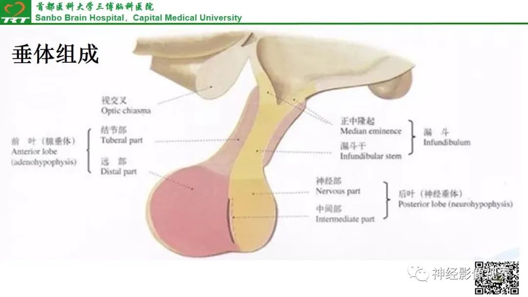 影像PPT - 垂体腺瘤的“丛征”-9 影像PPT - 垂体腺瘤的“丛征”-9