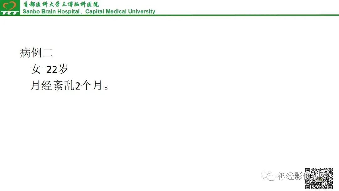 影像PPT - 垂体腺瘤的“丛征”-15 影像PPT - 垂体腺瘤的“丛征”-15