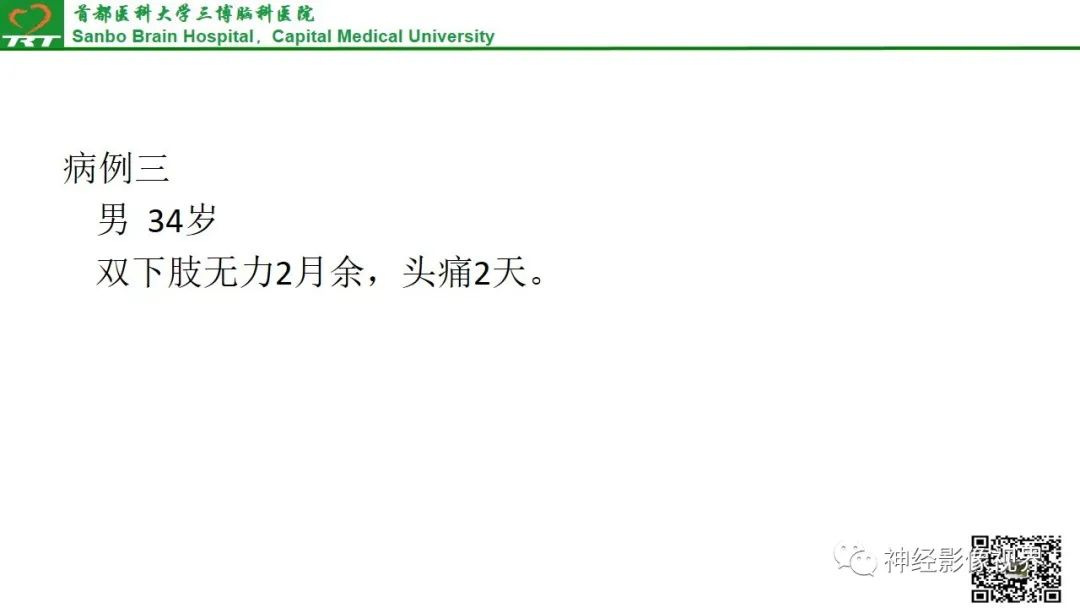 影像PPT - 垂体腺瘤的“丛征”-19 影像PPT - 垂体腺瘤的“丛征”-19