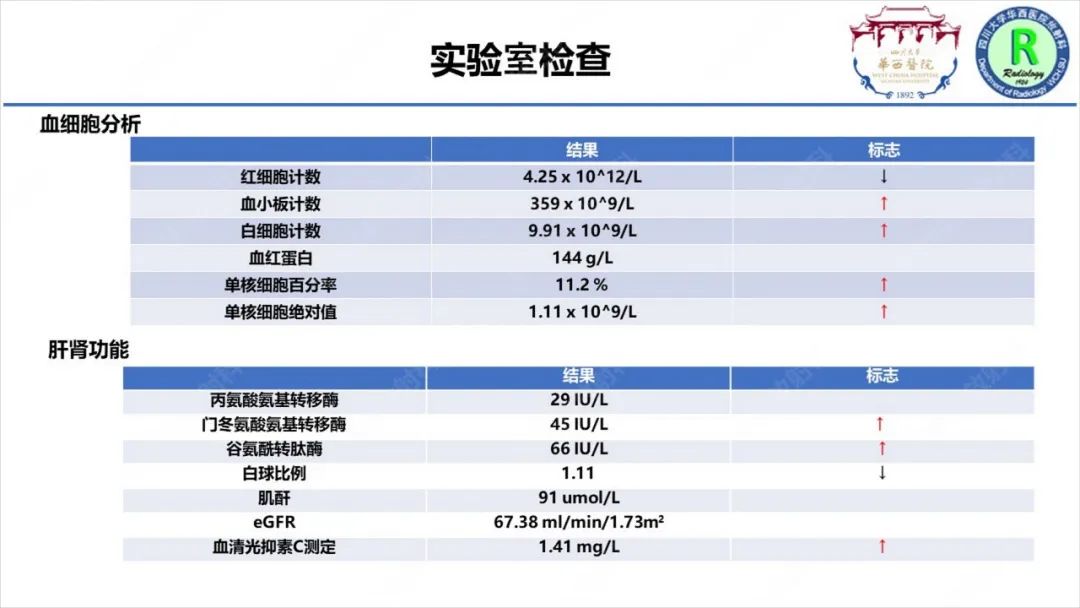 影像PPT - 【病例】McKittrick–Wheelock综合征1例CT及MR影像-2