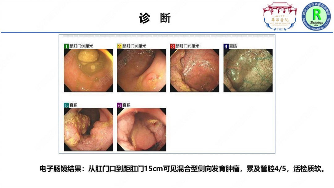 影像PPT - 【病例】McKittrick–Wheelock综合征1例CT及MR影像-13