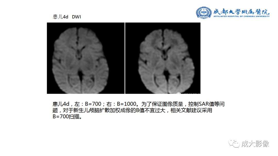 影像PPT - 【PPT】婴幼儿及胎儿头颅MRI成像要点-14
