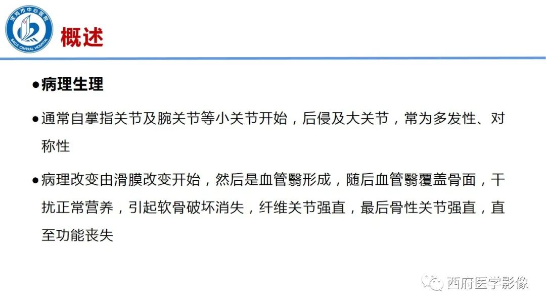 影像PPT - 【PPT】类风湿性关节炎的早期影像学诊断-4