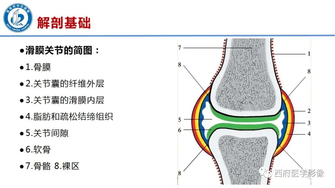 影像PPT - 【PPT】类风湿性关节炎的早期影像学诊断-7