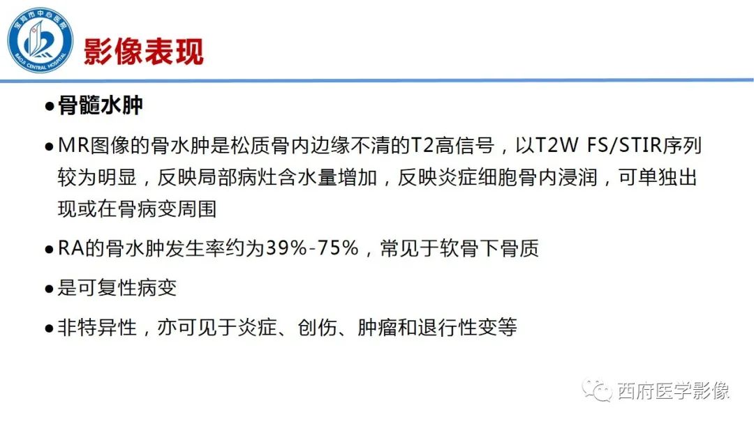 影像PPT - 【PPT】类风湿性关节炎的早期影像学诊断-16