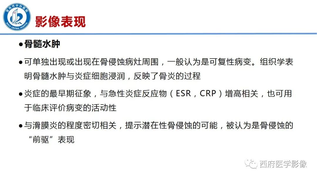 影像PPT - 【PPT】类风湿性关节炎的早期影像学诊断-17
