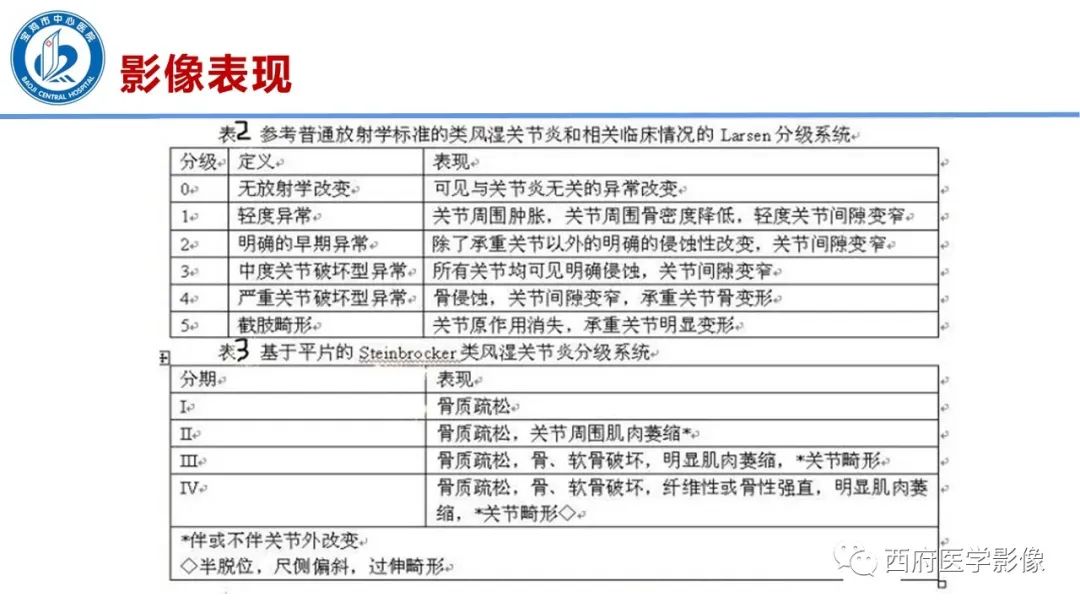 影像PPT - 【PPT】类风湿性关节炎的早期影像学诊断-23