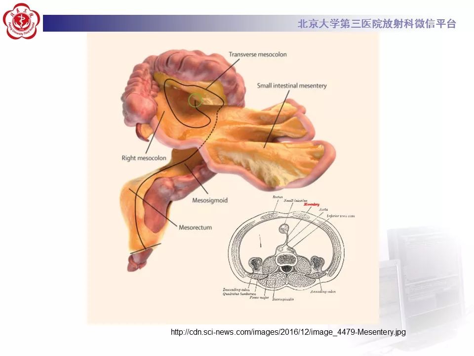 影像PPT - 【PPT】肠系膜脂膜炎-14