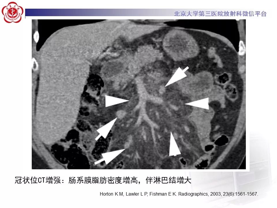 影像PPT - 【PPT】肠系膜脂膜炎-23