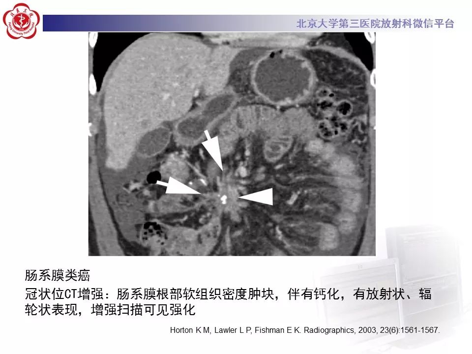 影像PPT - 【PPT】肠系膜脂膜炎-38