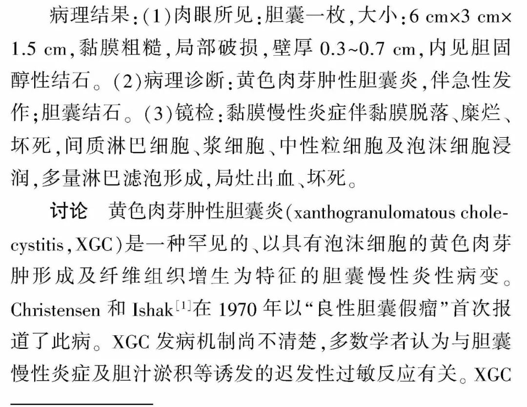 影像PPT - 【病例】黄色肉芽肿性胆囊炎1例影像诊断思维-5