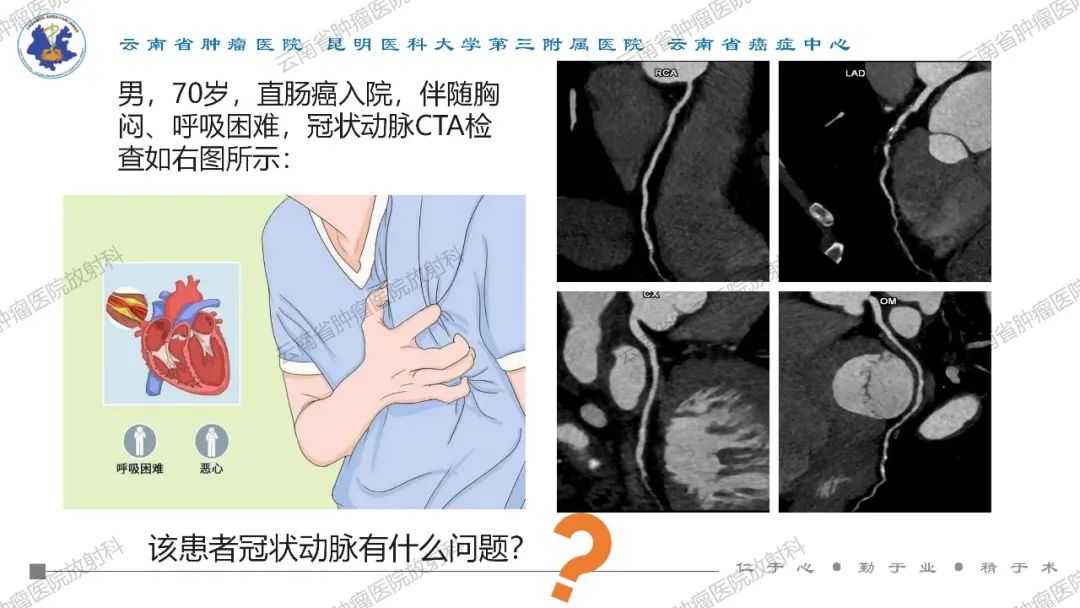 影像PPT - 【PPT】冠状动脉CTA报告规范化及后处理要求-2