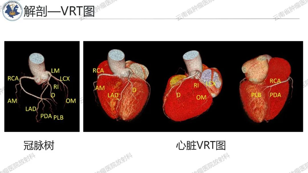 影像PPT - 【PPT】冠状动脉CTA报告规范化及后处理要求-7