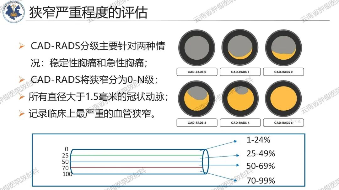 影像PPT - 【PPT】冠状动脉CTA报告规范化及后处理要求-14