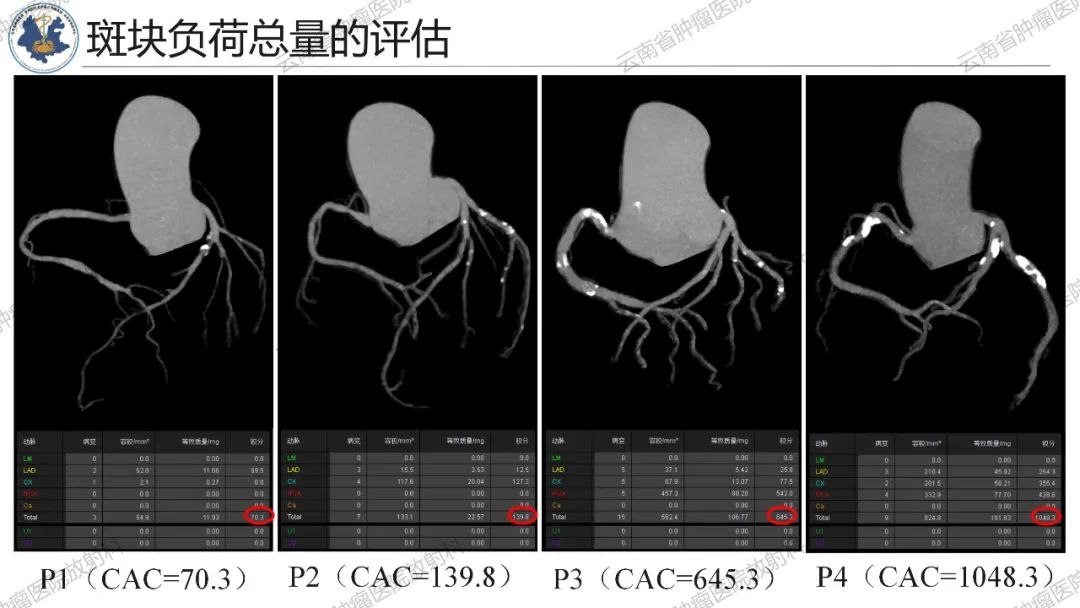 影像PPT - 【PPT】冠状动脉CTA报告规范化及后处理要求-19