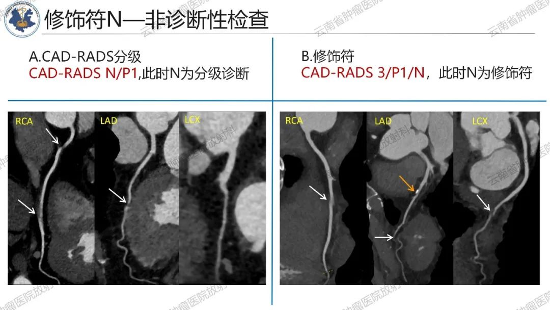 影像PPT - 【PPT】冠状动脉CTA报告规范化及后处理要求-22