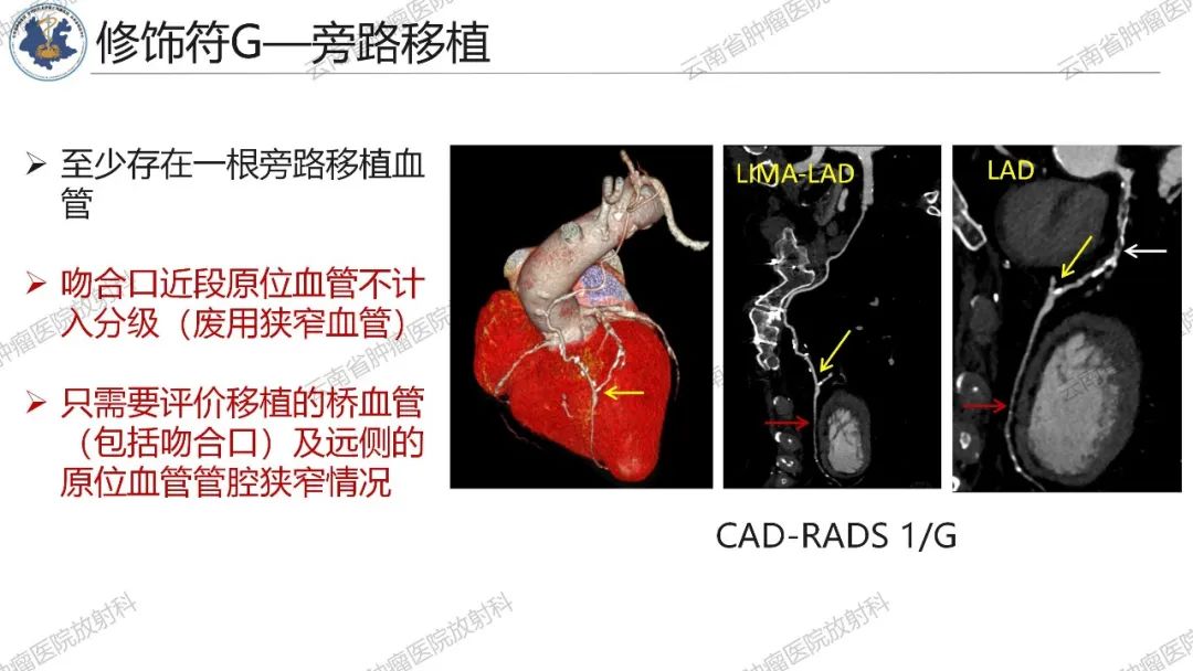 影像PPT - 【PPT】冠状动脉CTA报告规范化及后处理要求-25