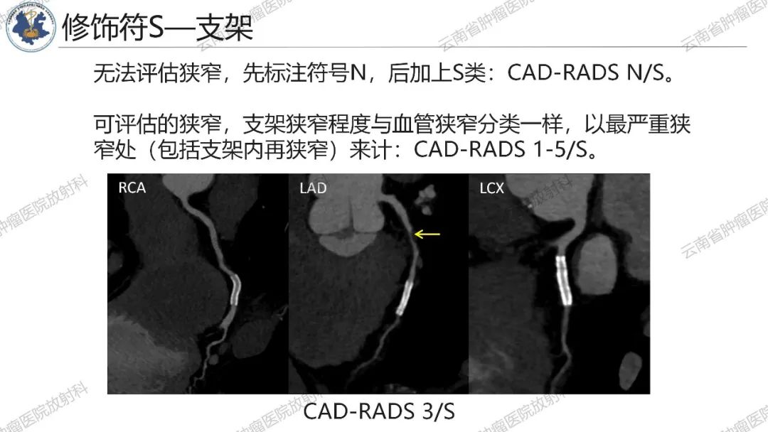 影像PPT - 【PPT】冠状动脉CTA报告规范化及后处理要求-23