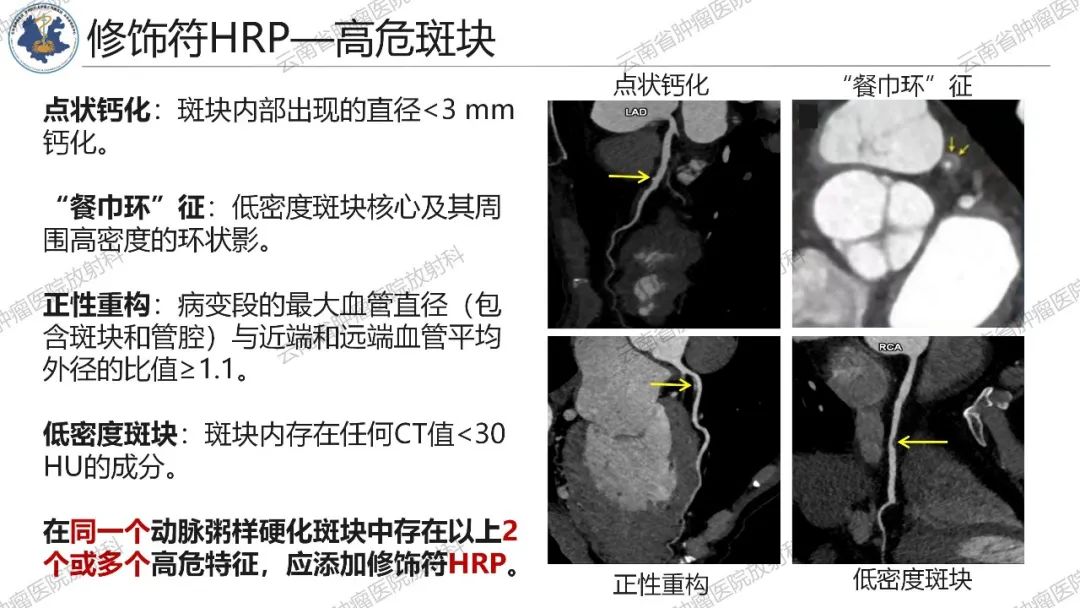 影像PPT - 【PPT】冠状动脉CTA报告规范化及后处理要求-24