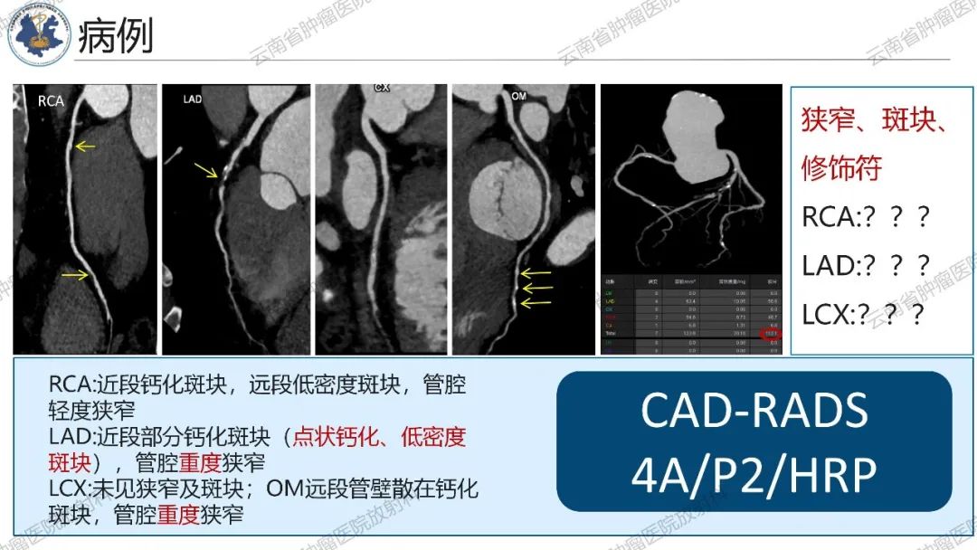 影像PPT - 【PPT】冠状动脉CTA报告规范化及后处理要求-36