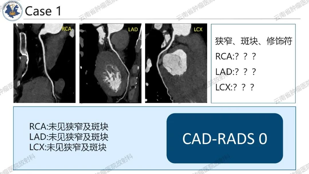 影像PPT - 【PPT】冠状动脉CTA报告规范化及后处理要求-42