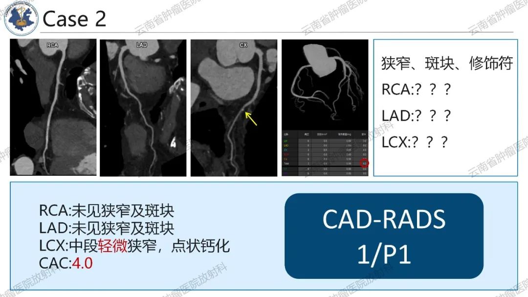 影像PPT - 【PPT】冠状动脉CTA报告规范化及后处理要求-43