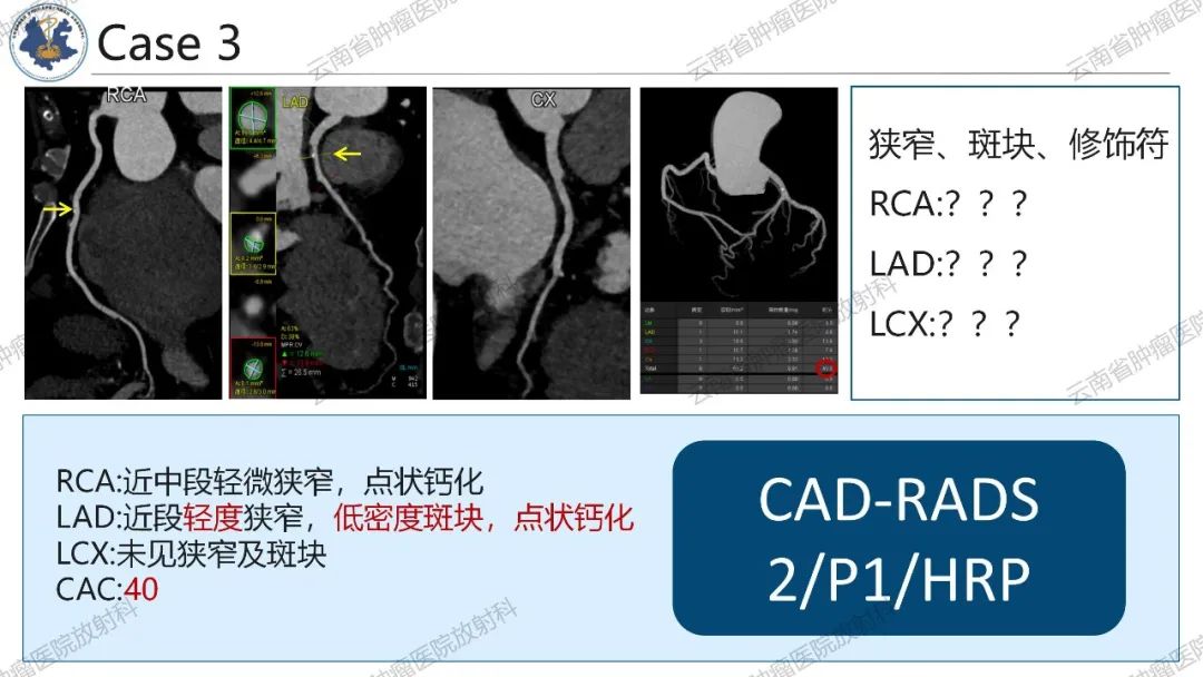影像PPT - 【PPT】冠状动脉CTA报告规范化及后处理要求-44