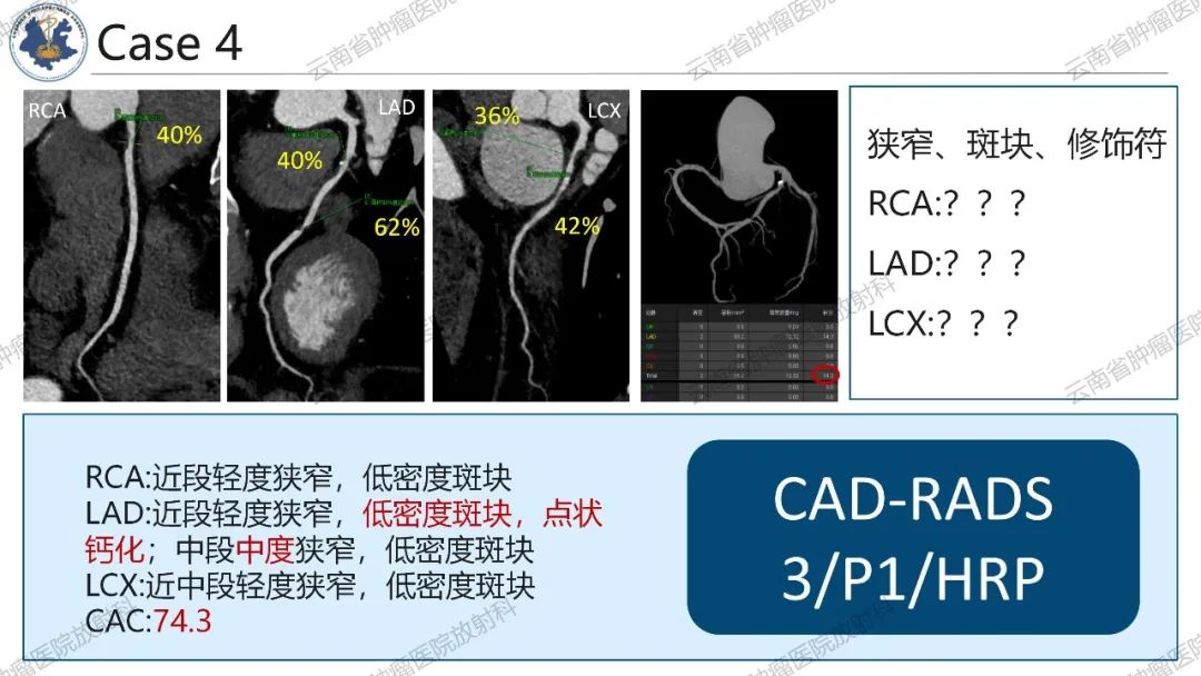 影像PPT - 【PPT】冠状动脉CTA报告规范化及后处理要求-45