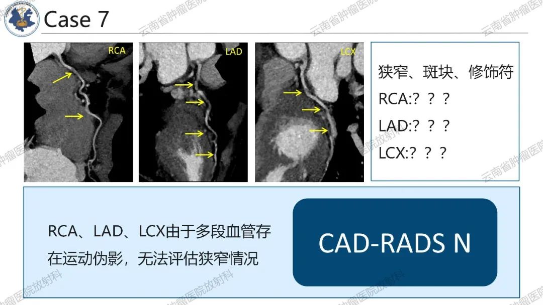 影像PPT - 【PPT】冠状动脉CTA报告规范化及后处理要求-48