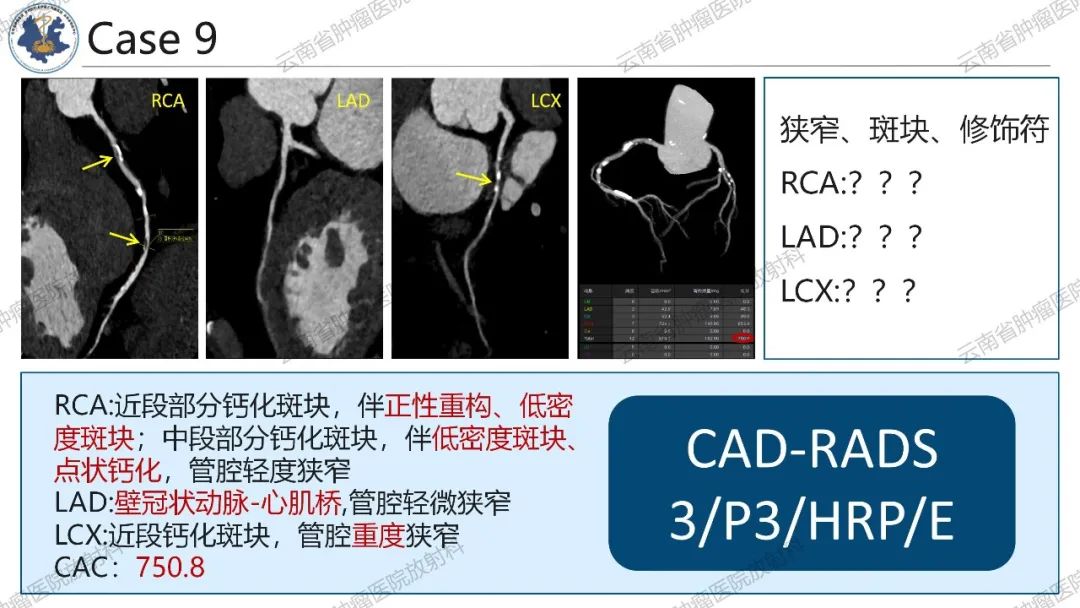 影像PPT - 【PPT】冠状动脉CTA报告规范化及后处理要求-50