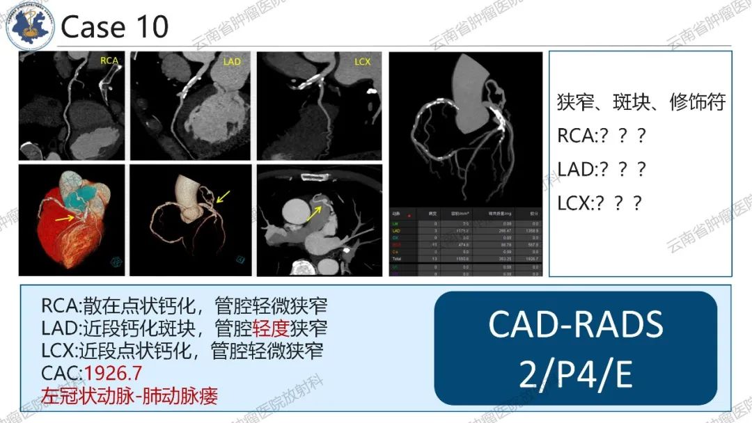 影像PPT - 【PPT】冠状动脉CTA报告规范化及后处理要求-51