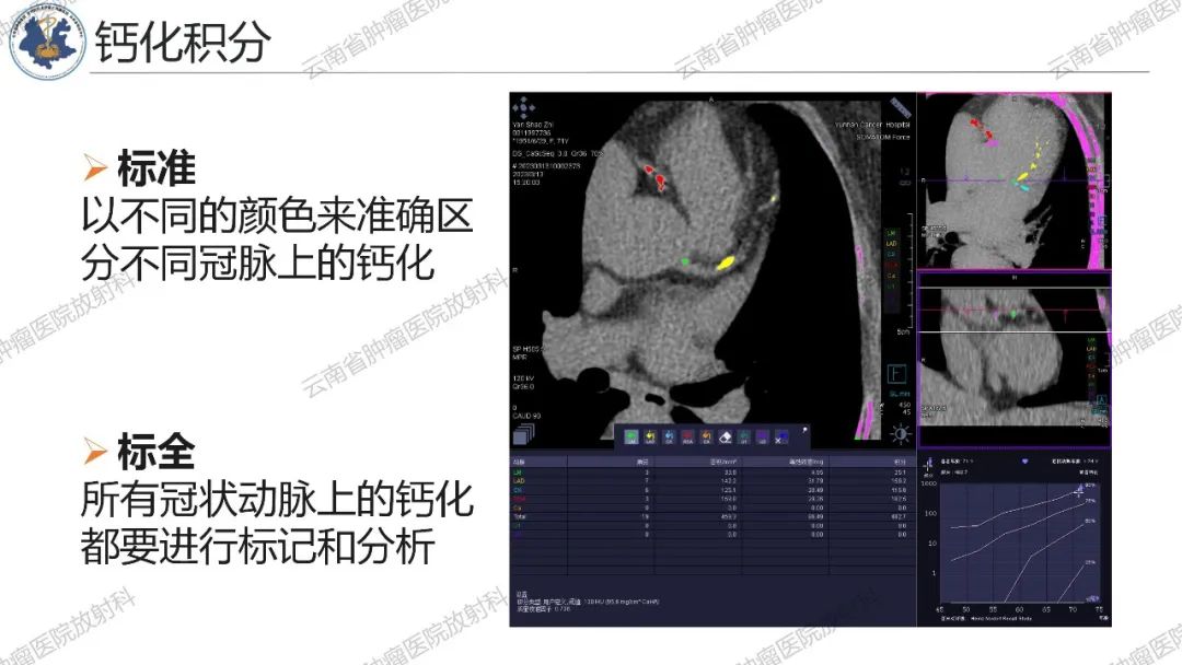 影像PPT - 【PPT】冠状动脉CTA报告规范化及后处理要求-64