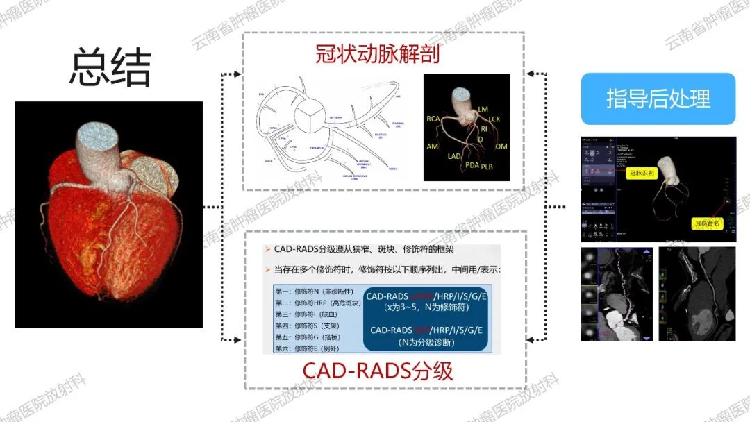 影像PPT - 【PPT】冠状动脉CTA报告规范化及后处理要求-67
