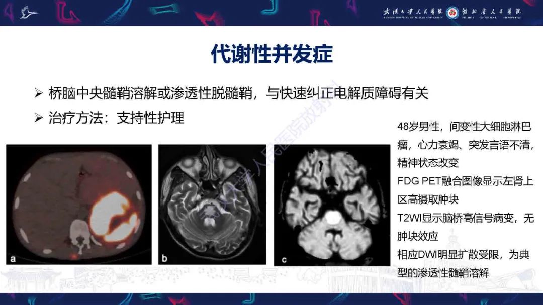 影像PPT - 【PPT】肿瘤相关中枢神经系统急症影像诊断-12