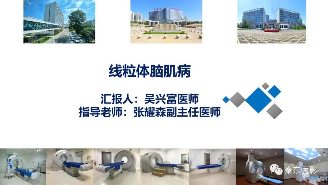影像PPT - 【病例】线粒体脑肌病1例CT及MR影像-1