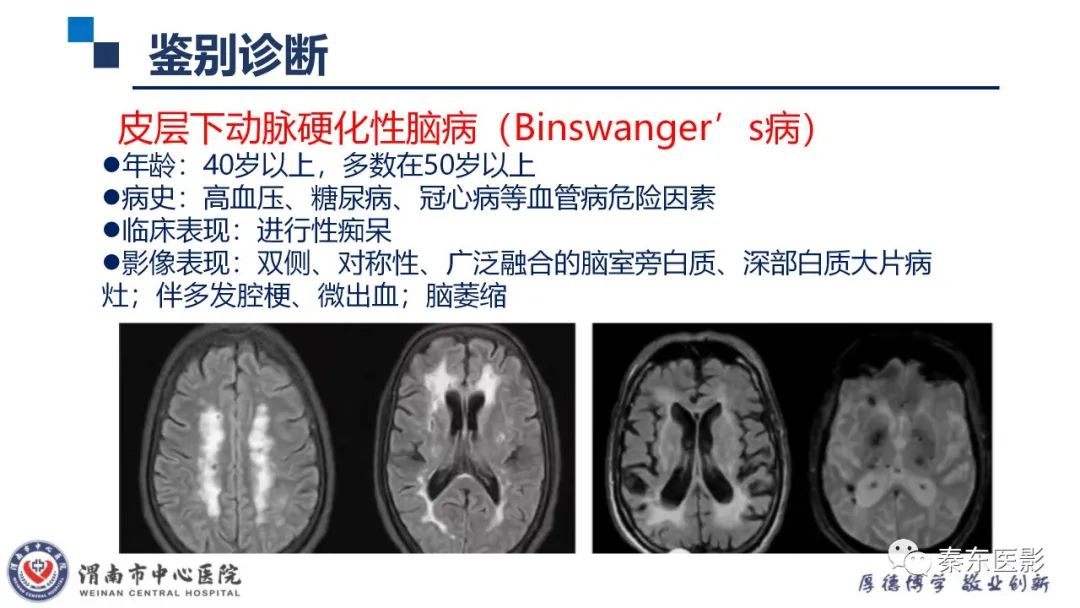 影像PPT - 【病例】线粒体脑肌病1例CT及MR影像-35