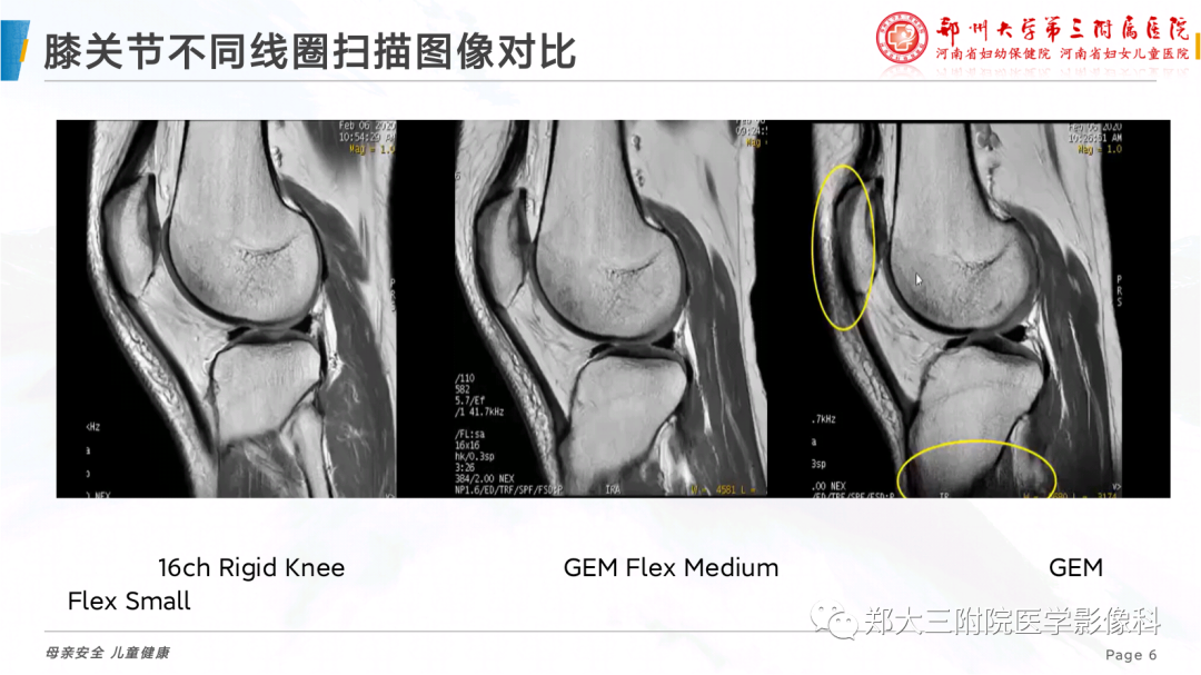 影像PPT - 【PPT】骨骼肌肉系统磁共振检查技术-6
