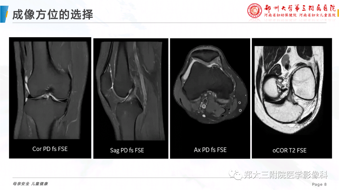 影像PPT - 【PPT】骨骼肌肉系统磁共振检查技术-8