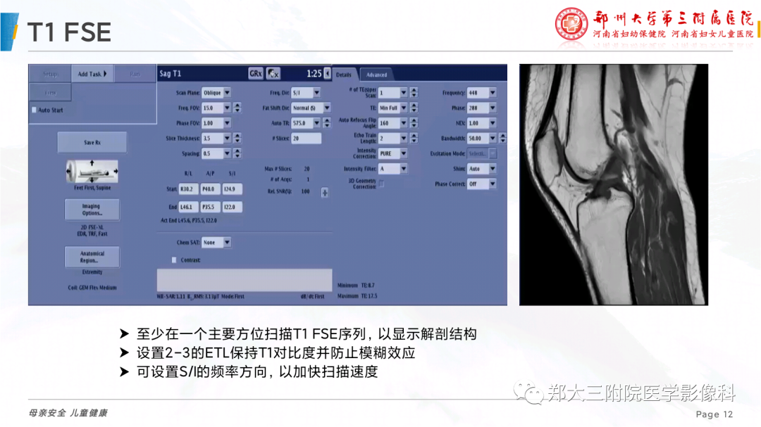 影像PPT - 【PPT】骨骼肌肉系统磁共振检查技术-12