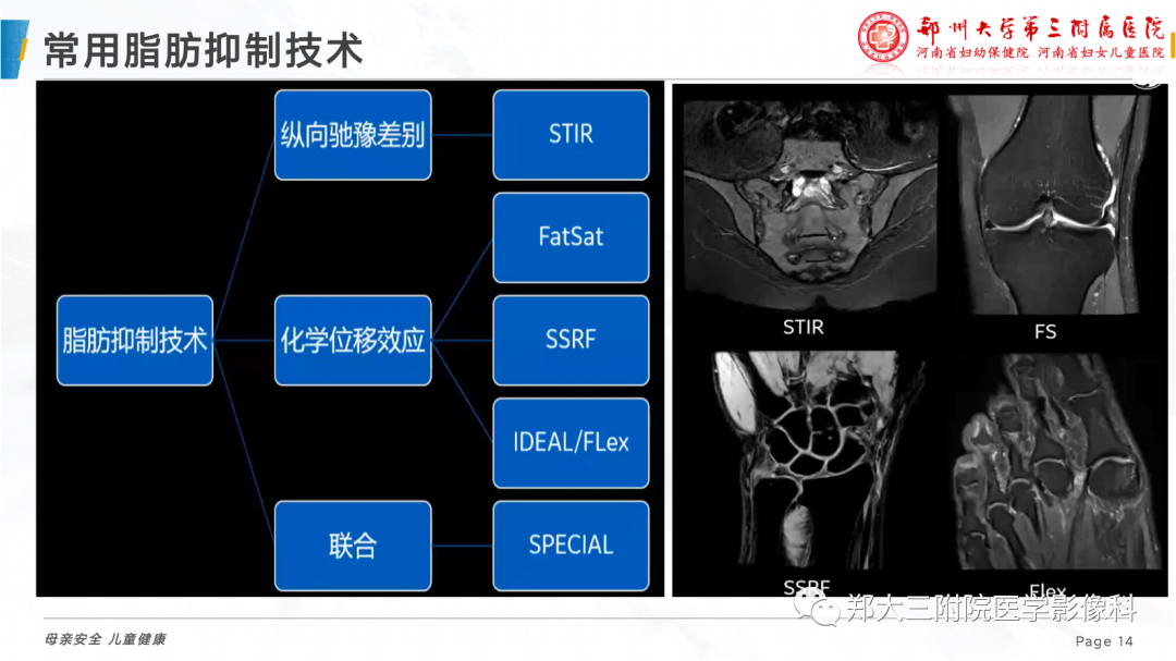 影像PPT - 【PPT】骨骼肌肉系统磁共振检查技术-14