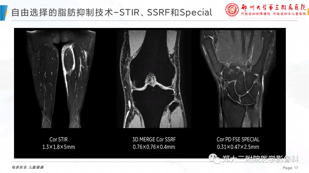 影像PPT - 【PPT】骨骼肌肉系统磁共振检查技术-17