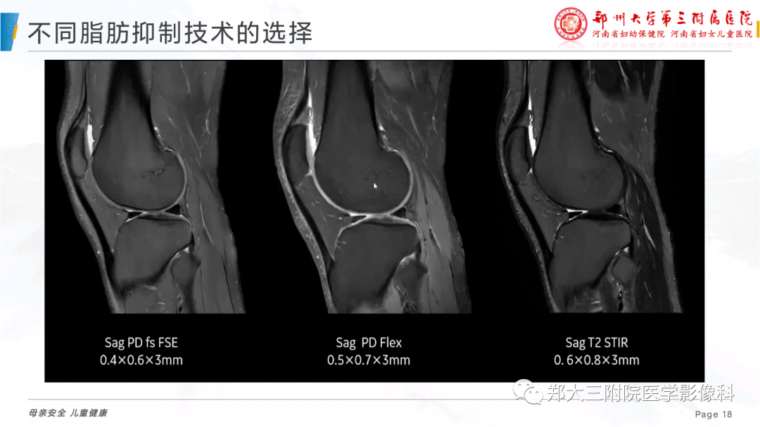 影像PPT - 【PPT】骨骼肌肉系统磁共振检查技术-18
